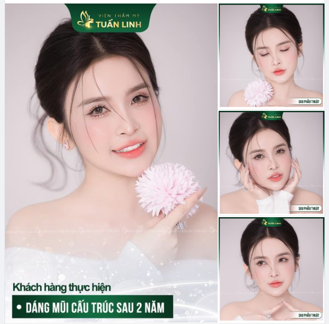 Nhan sắc xinh đẹp yêu kiều sau 2 năm nâng mũi!