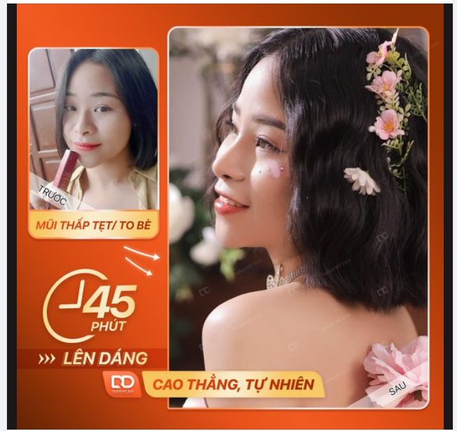 MŨI ĐẸP TỰ NHIÊN NHƯNG KHÔNG TỰ NHIÊN MÀ ĐẸP