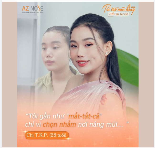 Gần như "mất-tất-cả" chỉ vì chọn nhầm nơi nâng mũi...