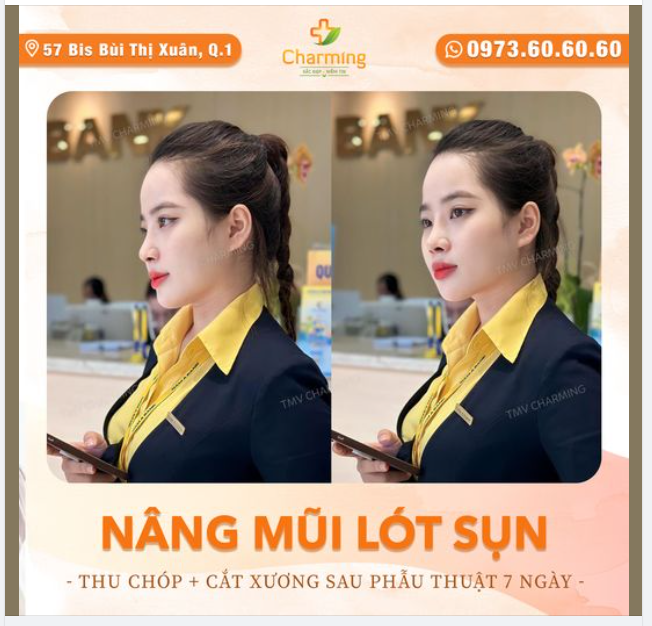 Nắng nơi em nắng mãi không tắt. Làm mũi rồi, em đẹp mãi không thôi
