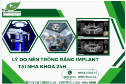 LÝ DO VÀ LỢI ÍCH CỦA TRỒNG RĂNG IMPLANT TẠI NHA KHOA 24H