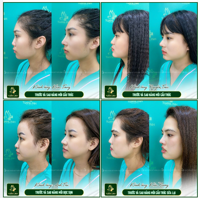 Không cần phải xinh đẹp như hotgirl Nhưng hãy là phiên bản đẹp nhất của chính mình bạn nhé!