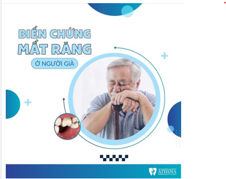 ĐỪNG XEM NHẸ VIỆC MẤT RĂNG LÂU NĂM Ở NGƯỜI GIÀ!!