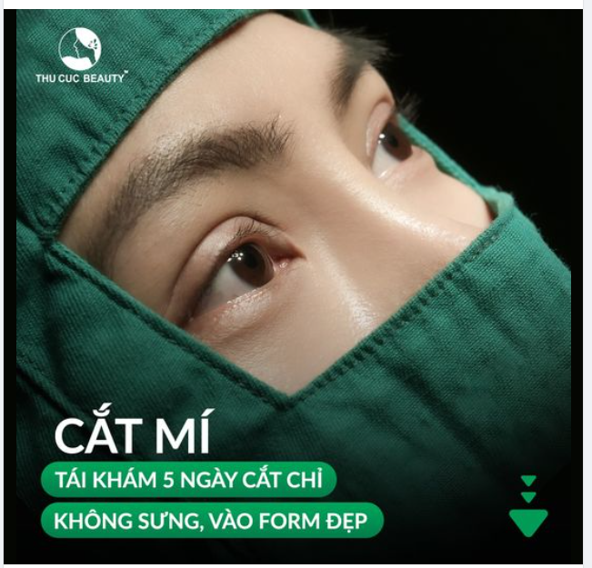 khách hàng tái khám sau 5 ngày cắt chỉ