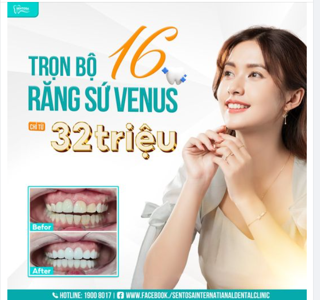 TRỌN BỘ 16 RĂNG SỨ VENUS TỪ 32.000.000Đ