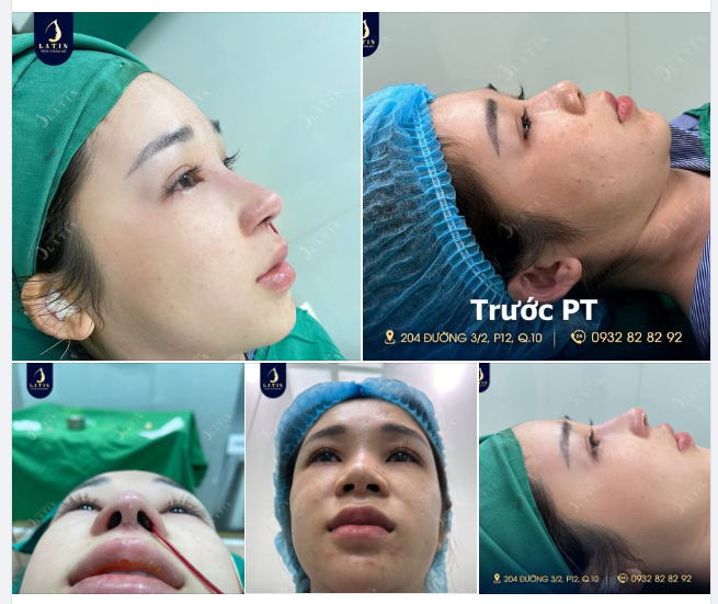 "Em thích dáng mũi cao nét, sắc sảo bác sĩ ơi"