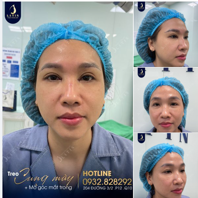 Đã mất rất nhiều thời gian suy nghĩ, cuối cùng chị gái quyết định treo cung mày, mở góc mắt trong tại Latin
