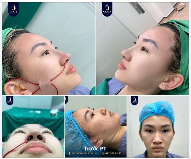 Kết quả này đã giúp em thêm tự tin chưa