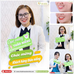 TỰ TIN CƯỜI, GIAO TIẾP, CHỤP ẢNH SAU THÁO NIỀNG RĂNG HÔ