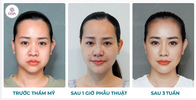 NGỠ NGÀNG TRƯỚC NHAN SẮC “VẠN NGƯỜI MÊ” CỦA NGƯỜI MẸ 3 CON SAU THẨM MỸ