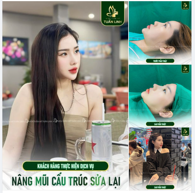 THẨM MỸ MẮT có làm bạn trẻ trung xinh đẹp hơn không?