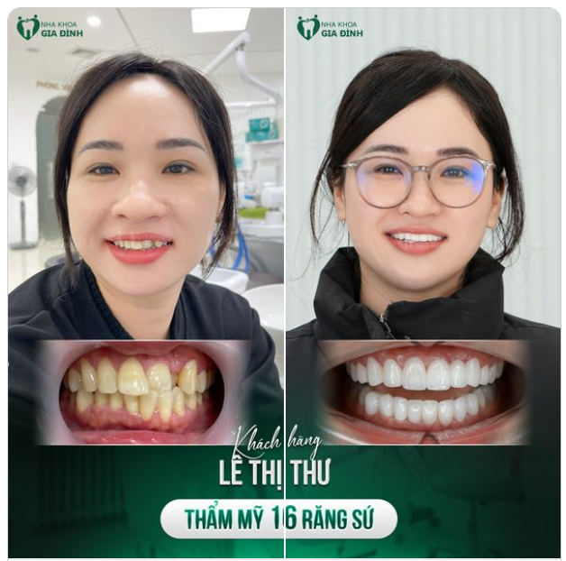 "ĐÁNG ĐỒNG TIỀN BÁT GẠO" KHI THAY MỚI NỤ CƯỜI