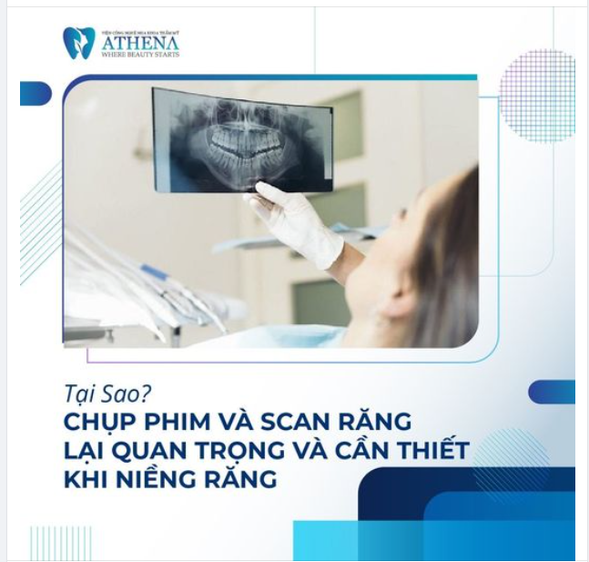 CHỤP PHIM VÀ SCAN RĂNG QUAN TRỌNG NHƯ NÀO KHI NIỀNG RĂNG?
