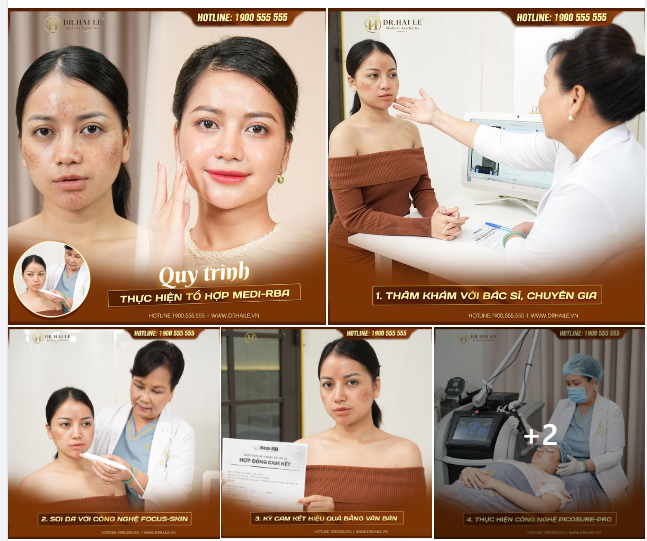 Bạn đã biết đến quy trình thực hiện tổ hợp Medi- RBA tại Dr Hải Lê ?