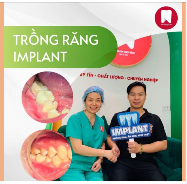 CẤY GHÉP IMPLANT - BÍ QUYẾT PHỤC HỒI RĂNG ĐÃ MẤT