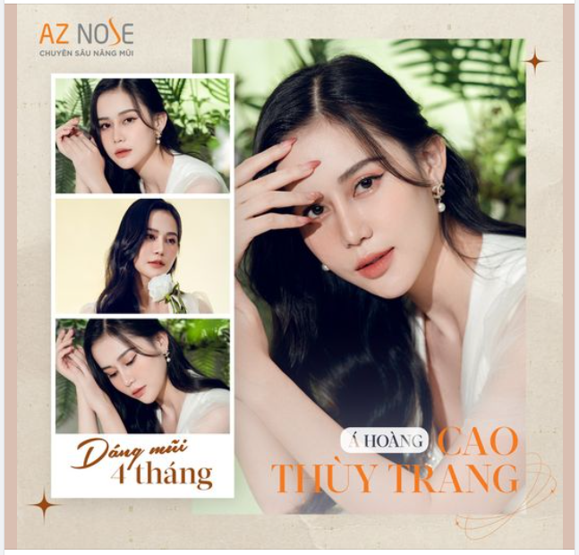Á hoàng CaoThùyTrang thần thái sau 4 tháng tái tạo dáng mũi