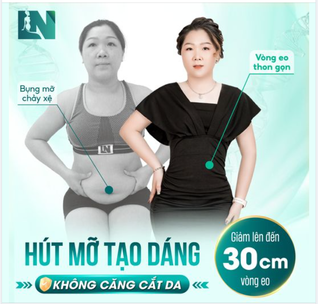 GIẢM ĐẾN 30cm VÒNG EO CHỈ SAU 1 LIỆU TRÌNH HÚT MỠ KHÔNG CĂNG CẮT DA CÙNG BS. LƯƠNG NGỌC