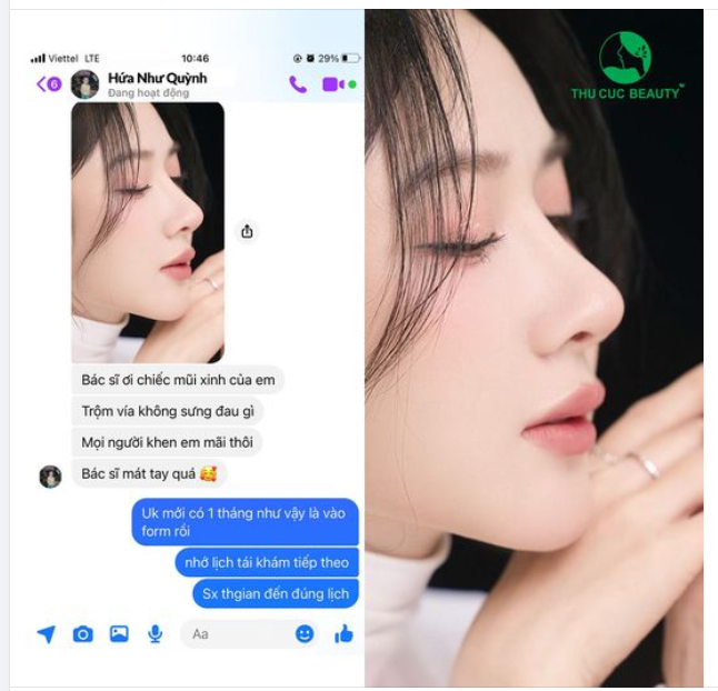 Feedback nâng mũi của khách hàng
