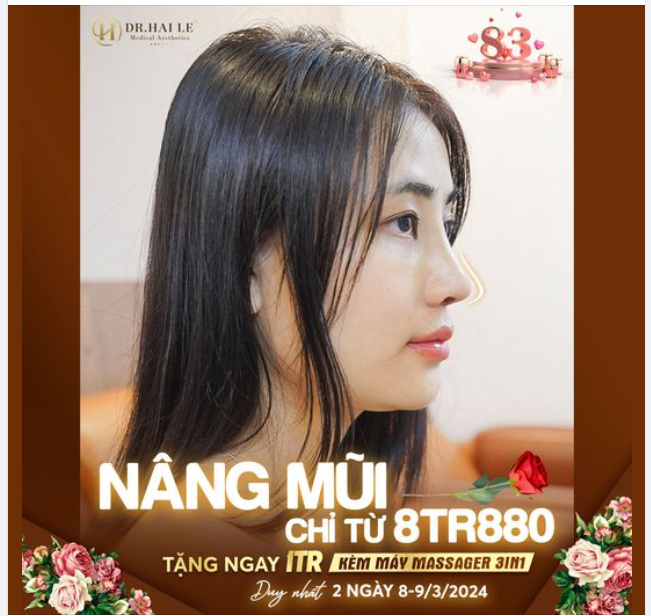 Địa chấn 2024 là đây Nâng mũi chỉ từ 8tr880
