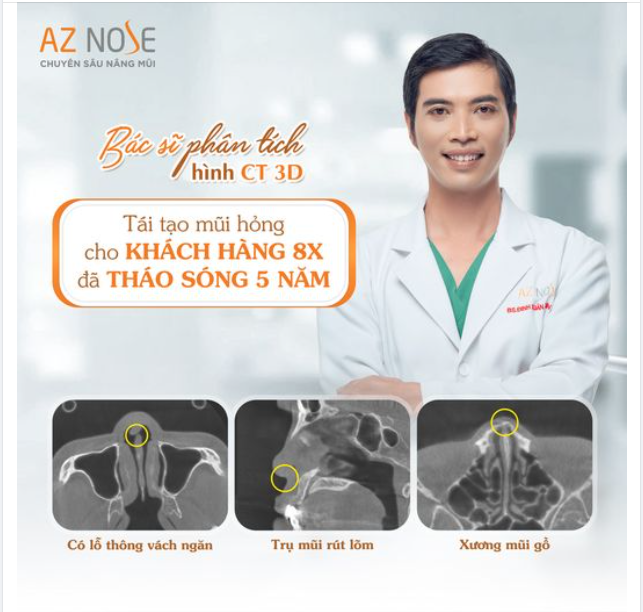 Tình trạng đặc biệt: Có lỗ thông vách ngăn