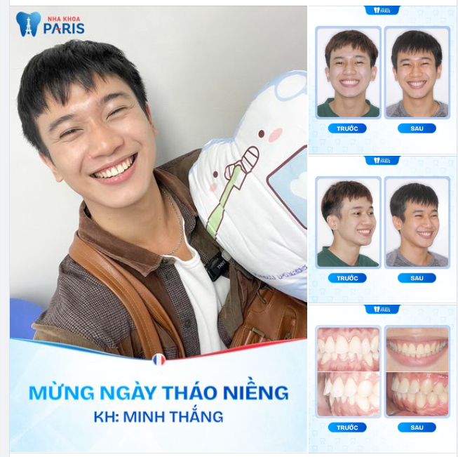 NỤ CƯỜI RẠNG RỠ NGÀY THÁO NIỀNG!