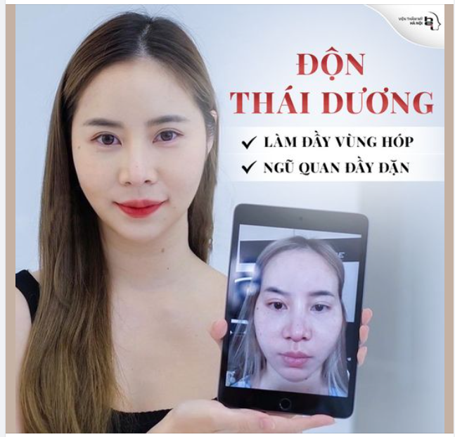 TẠM BIỆT KHUÔN MẶT TRÁI LÊ, HỐC HÁC