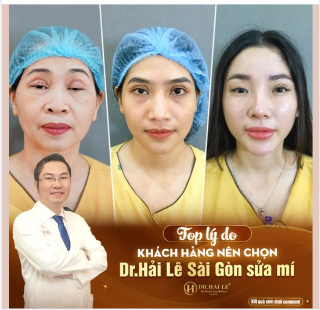 Nếu đang tìm kiếm cho mình một địa chỉ sửa mí uy tín và an toàn tại khu vực miền Nam, bạn không thể bỏ qua cái tên Dr.Hải Lê cơ sở Sài Gòn bởi những lý do sau: