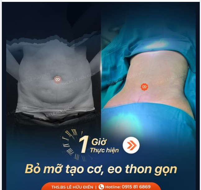 CHỈ SAU 1 GIỜ BỤNG MỠ HOÁ BỤNG CƠ, EO THON GỌN