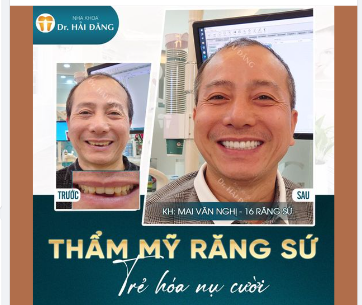 Một hàm răng đạt chuẩn không những đẹp mà nhất định cần phải đáp ứng độ an toàn và khỏe mạnh, giúp bệnh nhân tự tin và ăn uống được dễ dàng hơn.