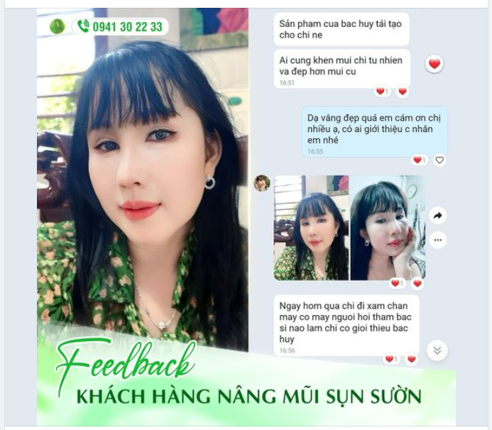 FEEDBACK MŨI SỬA LẠI SIÊU ƯNG CỦA CHỊ KHÁCH HÀNG