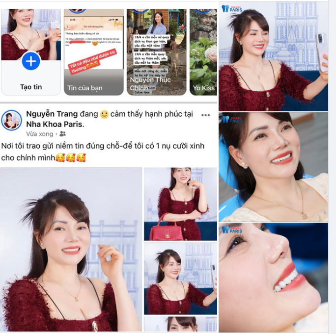 Nha khoa Paris - Nơi gửi trọn niềm tin của chị Trang cho nụ cười rạng rỡ với bọc răng sứ