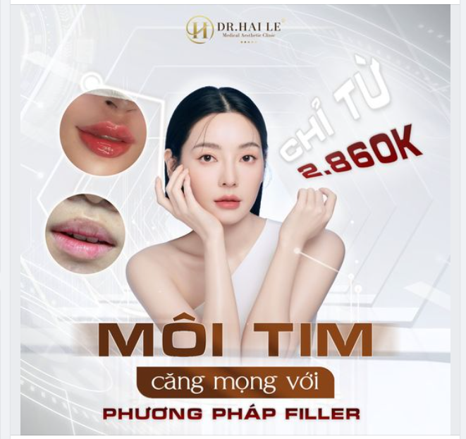 Môi tim căng mọng với phương pháp tiêm filler