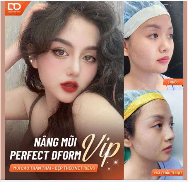 MŨI CAO THẦN THÁI - ĐẸP THEO NÉT RIÊNG