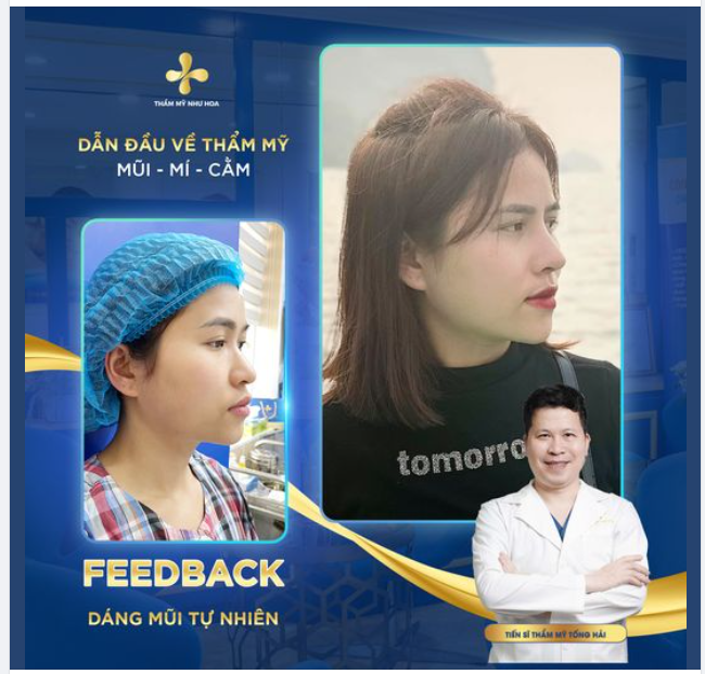 Có ai từng nghĩ 1 dáng mũi đẹp có thể thay đổi hoàn toàn diện mạo của mình không?