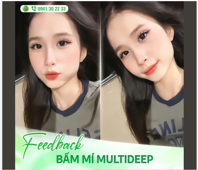 FEEDBACK BẤM MÍ MULTIDEEP TẠI SAIGON VENUS
