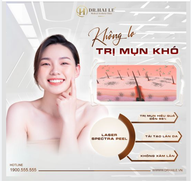 Không lo trị mụn khó đã có laser Spectra Peel 