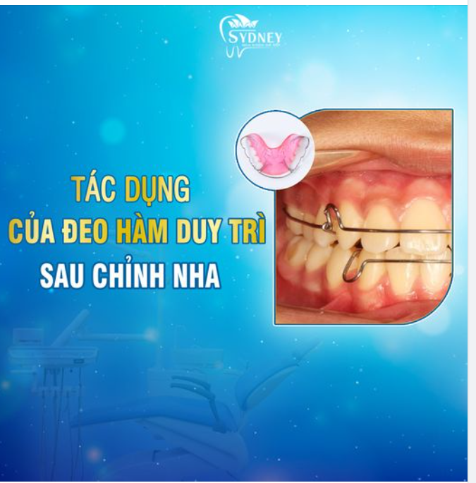 TÁC DỤNG CỦA ĐEO HÀM DUY TRÌ SAU CHỈNH NHA