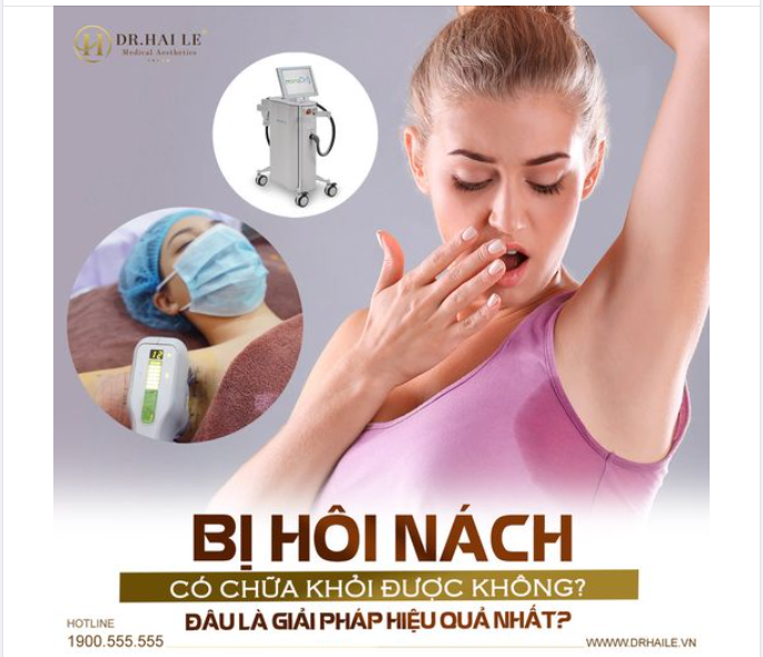 Bị hôi nách có chữa khỏi được không ? Đâu là giải pháp hiệu quả nhất?