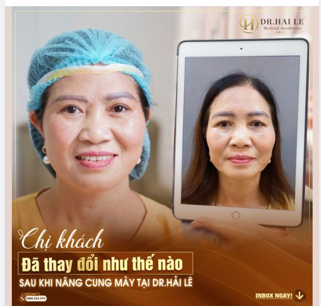 Chỉ với 30 phút thực hiện nhưng đã mang đến cho chị hiệu quả bất ngờ: