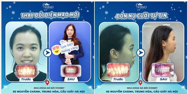 THAY ĐỔI DIỆN MẠO - ĐÓN NỤ CƯỜI TỰ TIN