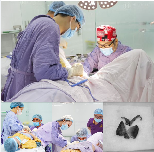 Sự hài lòng của khách hàng vẫn luôn là điều Dr.Hải Lê đặt lên hàng đầu đó ạ.