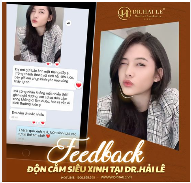 Feedback độn cằm siêu xinh tại Dr Hải Lê sau 1 tháng
