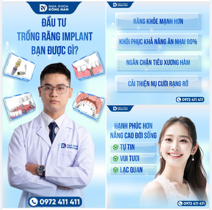 ​​​​​​​LÝ DO QUAN TRỌNG ĐỂ ĐẦU TƯ VÀO NỤ CƯỜI CỦA BẠN BẰNG CẤY GHÉP IMPLANT