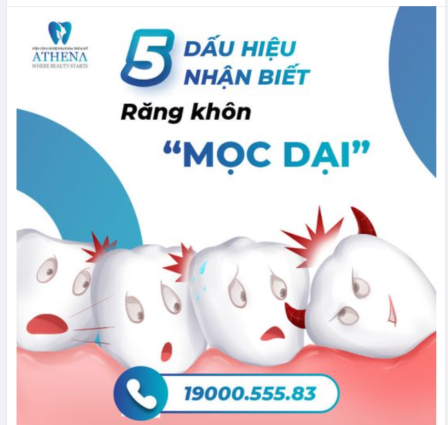 5 DẤU HIỆU NHẬN BIẾT RĂNG KHÔN "MỌC DẠI" XUẤT HIỆN NHỮNG CƠN ĐAU NHỨC THEO TỪNG ĐỢT