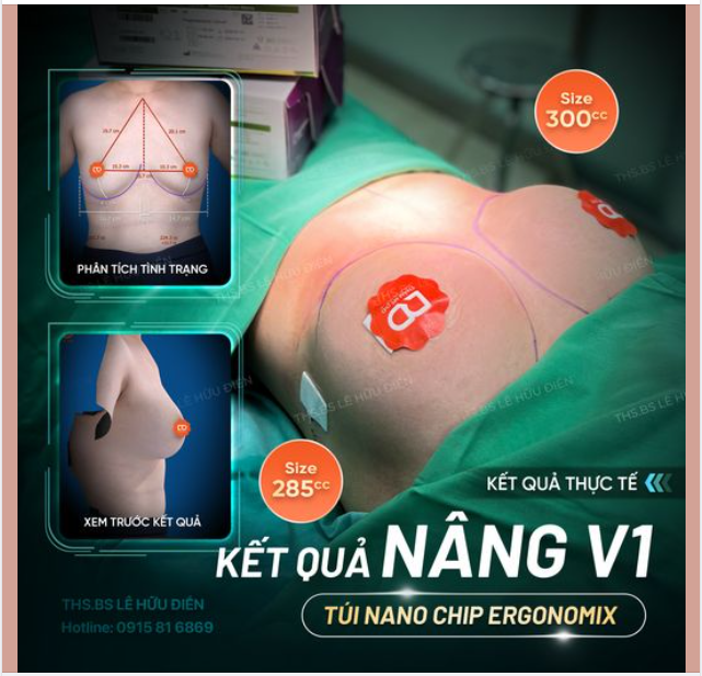 SỞ HỮU V1 CĂNG TRÒN CHƯA BAO GIỜ DỄ DÀNG NHƯ THẾ.