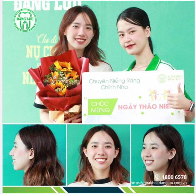 ĐÃ CÓ AI BẢO EM CƯỜI LÊN TRÔNG RẤT XINH CHƯA?