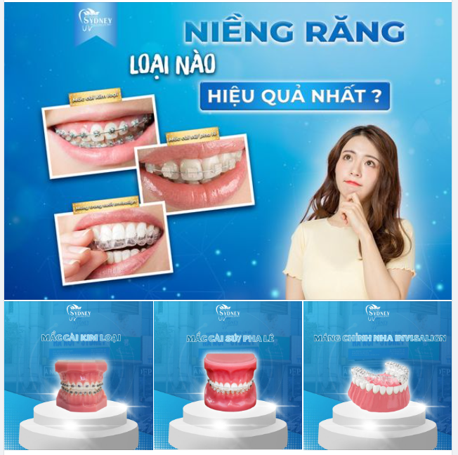 NIỀNG RĂNG LOẠI NÀO HIỆU QUẢ NHẤT?
