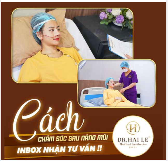 Mách nhỏ bạn cách chăm sóc sau nâng mũi