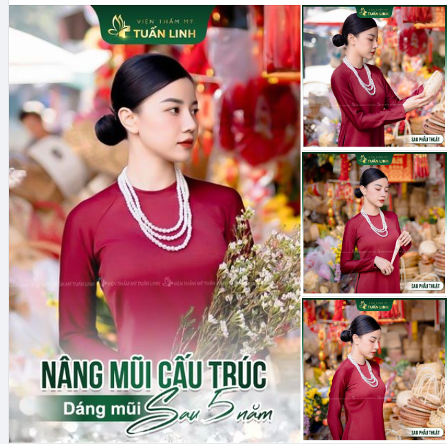 Để biết mình có thể xinh đẹp đến nhường nào, hãy thay đổi dáng mũi - bộ phận quyết định đến 70% vẻ đẹp gương mặt của bạn!!