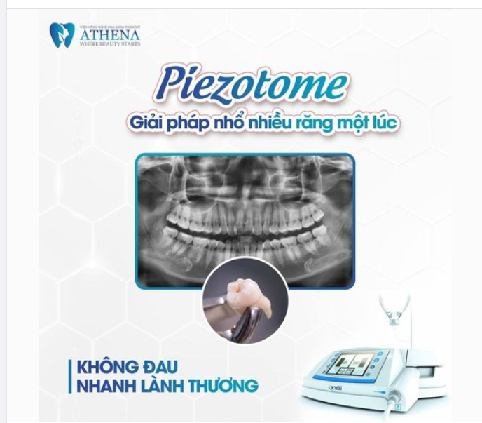 NHỔ NHIỀU RĂNG KHÔN NHƯNG KHÔNG ĐAU !? CỰC ĐƠN GIẢN VỚI MÁY PIEZOTOME TẠI NHA KHOA ATHENA